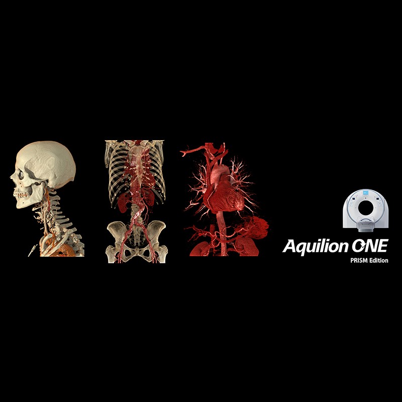 Компьютерный томограф Canon Aquilion ONE PRISM